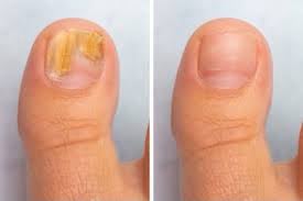 How much revanail cost